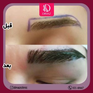 کلینیک ‏زیبایی ‏دیناز ‏خدمات ‏کاشت ‏مو ‏و ‏کاشت ‏ابرو ‏و ‏بلفاروپلاستی ‏در ‏تهران ‏سعادت ‏آباد ‏میدان ‏کتاب 18