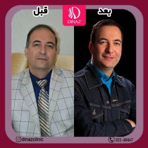 کلینیک ‏زیبایی ‏دیناز ‏خدمات ‏کاشت ‏مو ‏و ‏کاشت ‏ابرو ‏و ‏بلفاروپلاستی ‏در ‏تهران ‏سعادت ‏آباد ‏میدان ‏کتاب