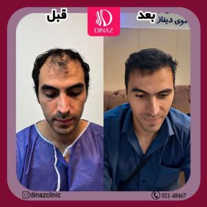 کلینیک ‏زیبایی ‏دیناز ‏خدمات ‏کاشت ‏مو ‏و ‏کاشت ‏ابرو ‏و ‏بلفاروپلاستی ‏در ‏تهران ‏سعادت ‏آباد ‏میدان ‏کتاب 4