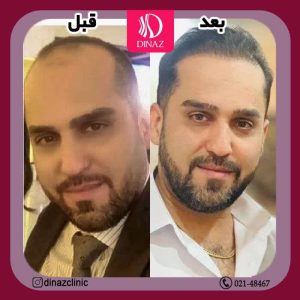 کلینیک ‏زیبایی ‏دیناز ‏خدمات ‏کاشت ‏مو ‏و ‏کاشت ‏ابرو ‏و ‏بلفاروپلاستی ‏در ‏تهران ‏سعادت ‏آباد ‏میدان ‏کتاب 5