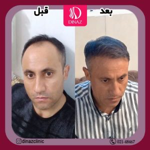 کلینیک ‏زیبایی ‏دیناز ‏خدمات ‏کاشت ‏مو ‏و ‏کاشت ‏ابرو ‏و ‏بلفاروپلاستی ‏در ‏تهران ‏سعادت ‏آباد ‏میدان ‏کتاب 7