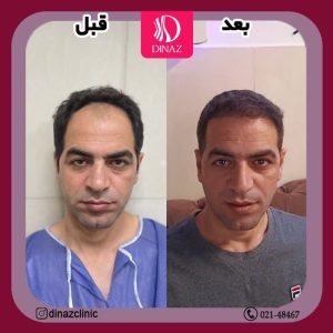 کلینیک ‏زیبایی ‏دیناز ‏خدمات ‏کاشت ‏مو ‏و ‏کاشت ‏ابرو ‏و ‏بلفاروپلاستی ‏در ‏تهران ‏سعادت ‏آباد ‏میدان ‏کتاب 8