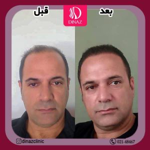 کلینیک ‏زیبایی ‏دیناز ‏خدمات ‏کاشت ‏مو ‏و ‏کاشت ‏ابرو ‏و ‏بلفاروپلاستی ‏در ‏تهران ‏سعادت ‏آباد ‏میدان ‏کتاب 9