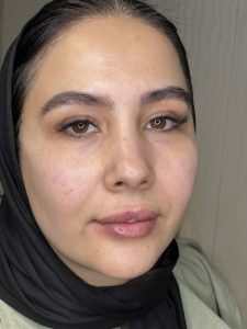 ‏نورالیز ‏الماس ‏فیشال ‏تخصصی ‏پوست ‏پاکسازی ‏پوست ‏هایفوتراپی ‏مزوتراپی ‏در ‏تهران ‏شهرک ‏آزادی 4