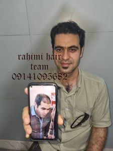 کلینیک ‏کاشت ‏موی ‏رحیمی ‏مزوتراپی ‏پی ‏ار ‏پی ‏کاشت ‏تخصصی ‏مو ‏در ‏تبریز ‏ولیعصر 3