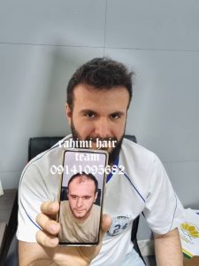 کلینیک ‏کاشت ‏موی ‏رحیمی ‏مزوتراپی ‏پی ‏ار ‏پی ‏کاشت ‏تخصصی ‏مو ‏در ‏تبریز ‏ولیعصر 5