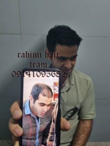 کلینیک ‏کاشت ‏موی ‏رحیمی ‏مزوتراپی ‏پی ‏ار ‏پی ‏کاشت ‏تخصصی ‏مو ‏در ‏تبریز ‏ولیعصر 7