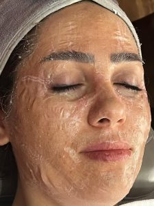 خدمات فیشال کروبکسی تراپی آنزیم تراپی مزونیدلینگ در گوهردشت کرج 5