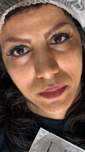 زیبایی الی بیوتی خدمات فیشال پاکسازی پوست لیفت جوانسازی مزونیدلینگ در تهران پاسداران 13