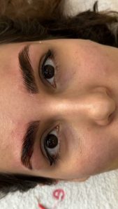 زیبایی الی بیوتی خدمات فیشال پاکسازی پوست لیفت جوانسازی مزونیدلینگ در تهران پاسداران 2