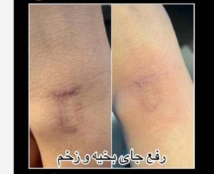 دکتر قدیانی فر خدمات تزریق بوتاکس مزوژل مزوتراپی در تهران زعفرانیه 25