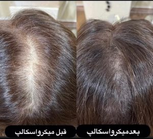سالن زیبایی شمیم خدمات ناخن میکاپ تاتو در ساری روبروی پارک آفتاب 13