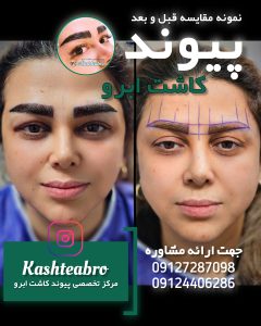 کلینیک ‏زیبایی ‏کاشت ‏ابرو ‏بلفاروپلاستی ‏لیپو ‏غبغب ‏بوکال ‏فت ‏سانترال ‏لب ‏لیفت ‏شقیقه ‏در ‏تهران ‏یوسف ‏آباد 2