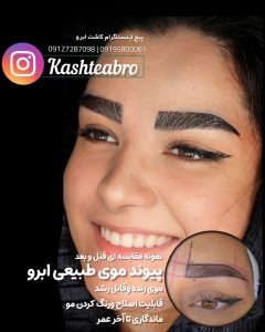 کلینیک ‏زیبایی ‏کاشت ‏ابرو ‏بلفاروپلاستی ‏لیپو ‏غبغب ‏بوکال ‏فت ‏سانترال ‏لب ‏لیفت ‏شقیقه ‏در ‏تهران ‏یوسف ‏آباد 3