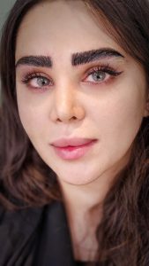 کلینیک ‏زیبایی ‏کاشت ‏ابرو ‏بلفاروپلاستی ‏لیپو ‏غبغب ‏بوکال ‏فت ‏سانترال ‏لب ‏لیفت ‏شقیقه ‏در ‏تهران ‏یوسف ‏آباد 4