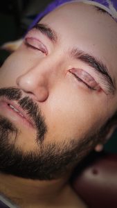 کلینیک ‏زیبایی ‏کاشت ‏ابرو ‏بلفاروپلاستی ‏لیپو ‏غبغب ‏بوکال ‏فت ‏سانترال ‏لب ‏لیفت ‏شقیقه ‏در ‏تهران ‏یوسف ‏آباد 6