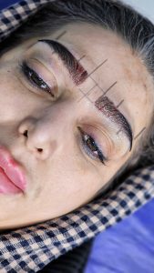 کلینیک ‏زیبایی ‏کاشت ‏ابرو ‏بلفاروپلاستی ‏لیپو ‏غبغب ‏بوکال ‏فت ‏سانترال ‏لب ‏لیفت ‏شقیقه ‏در ‏تهران ‏یوسف ‏آباد 8