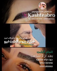 کلینیک ‏زیبایی ‏کاشت ‏ابرو ‏بلفاروپلاستی ‏لیپو ‏غبغب ‏بوکال ‏فت ‏سانترال ‏لب ‏لیفت ‏شقیقه ‏در ‏تهران ‏یوسف ‏آباد 9