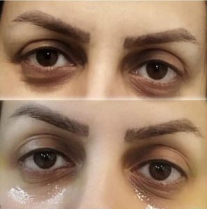 دکتر ‏فهیمه ‏درفشی ‏خدمات ‏مزوژل ‏کاشت ‏مو ‏بوتاکس ‏در ‏تهران شریعتی 2 1