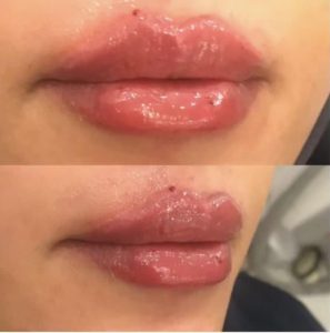 دکتر ‏فهیمه ‏درفشی ‏خدمات ‏مزوژل ‏کاشت ‏مو ‏بوتاکس ‏در ‏تهران شریعتی 3 1