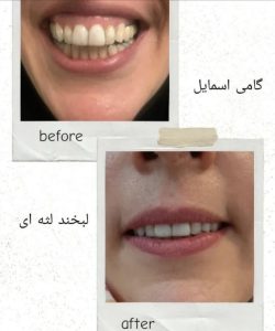 دکتر ‏فهیمه ‏درفشی ‏خدمات ‏مزوژل ‏کاشت ‏مو ‏بوتاکس ‏در ‏تهران شریعتی 4 1