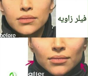 دکتر ‏فهیمه ‏درفشی ‏خدمات ‏مزوژل ‏کاشت ‏مو ‏بوتاکس ‏در ‏تهران شریعتی 7 1