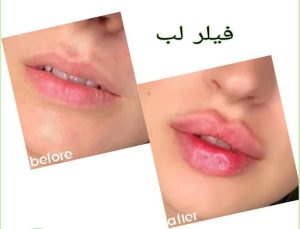 دکتر ‏فهیمه ‏درفشی ‏خدمات ‏مزوژل ‏کاشت ‏مو ‏بوتاکس ‏در ‏تهران شریعتی 8 1