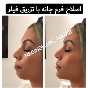 Snapinsta.app 209327767 225869962539470 857801798858515640 n 1080 2