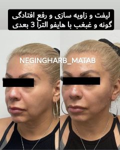 Snapinsta.app 217617160 336670244669508 5476524849782603223 n 1080 2