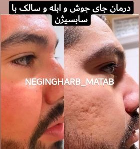 Snapinsta.app 234748225 199498285528650 2019022314638226302 n 1080 2