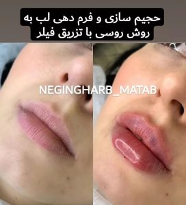 Snapinsta.app 238874043 542766417068727 2630812477375245745 n 1080 3
