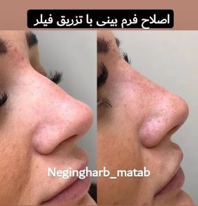 Snapinsta.app 241106977 527406885014810 5150844614218235662 n 1080 2