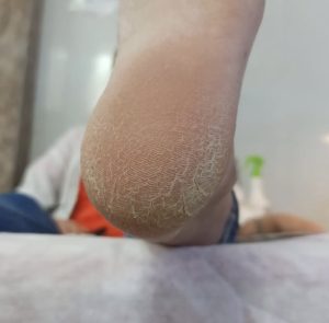 IMG 3356 3